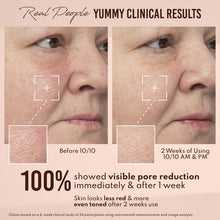 Load image into Gallery viewer, Danessa Myricks : Yummy Skin 10/10 Barrier Boost Hyaluronic Acid + Ectoin Plumping Serum 50ml