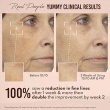 Load image into Gallery viewer, Danessa Myricks : Yummy Skin 10/10 Barrier Boost Hyaluronic Acid + Ectoin Plumping Serum 50ml