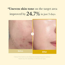 Load image into Gallery viewer, Medicube Skincare : Kojic Acid Turmeric Overnight Wrapping Mask 75ml