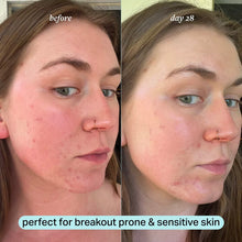 Load image into Gallery viewer, Cocokind Skincare : Calming Magnesium Facial Mist 120ml