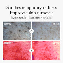 Load image into Gallery viewer, Medicube Skincare : Red Succinic Acid - 70 pads