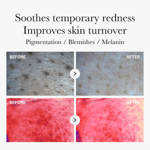 Medicube Skincare : Red Succinic Acid - 70 pads